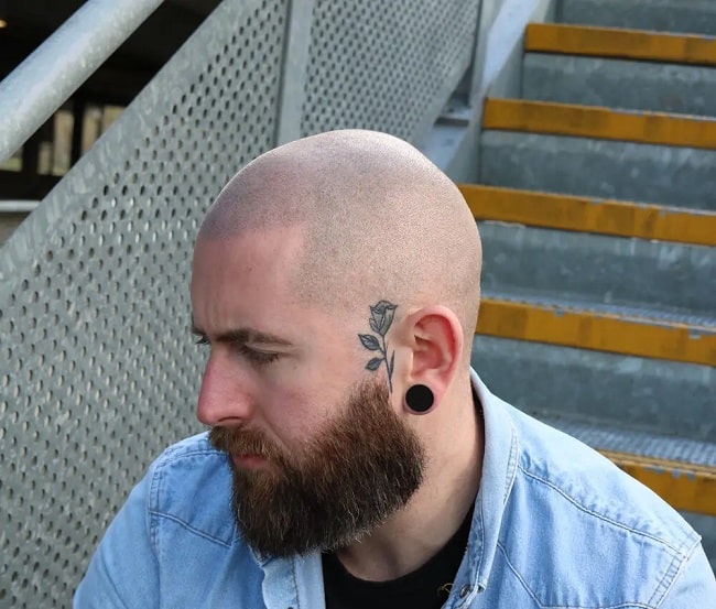 Scalp Micropigmentation